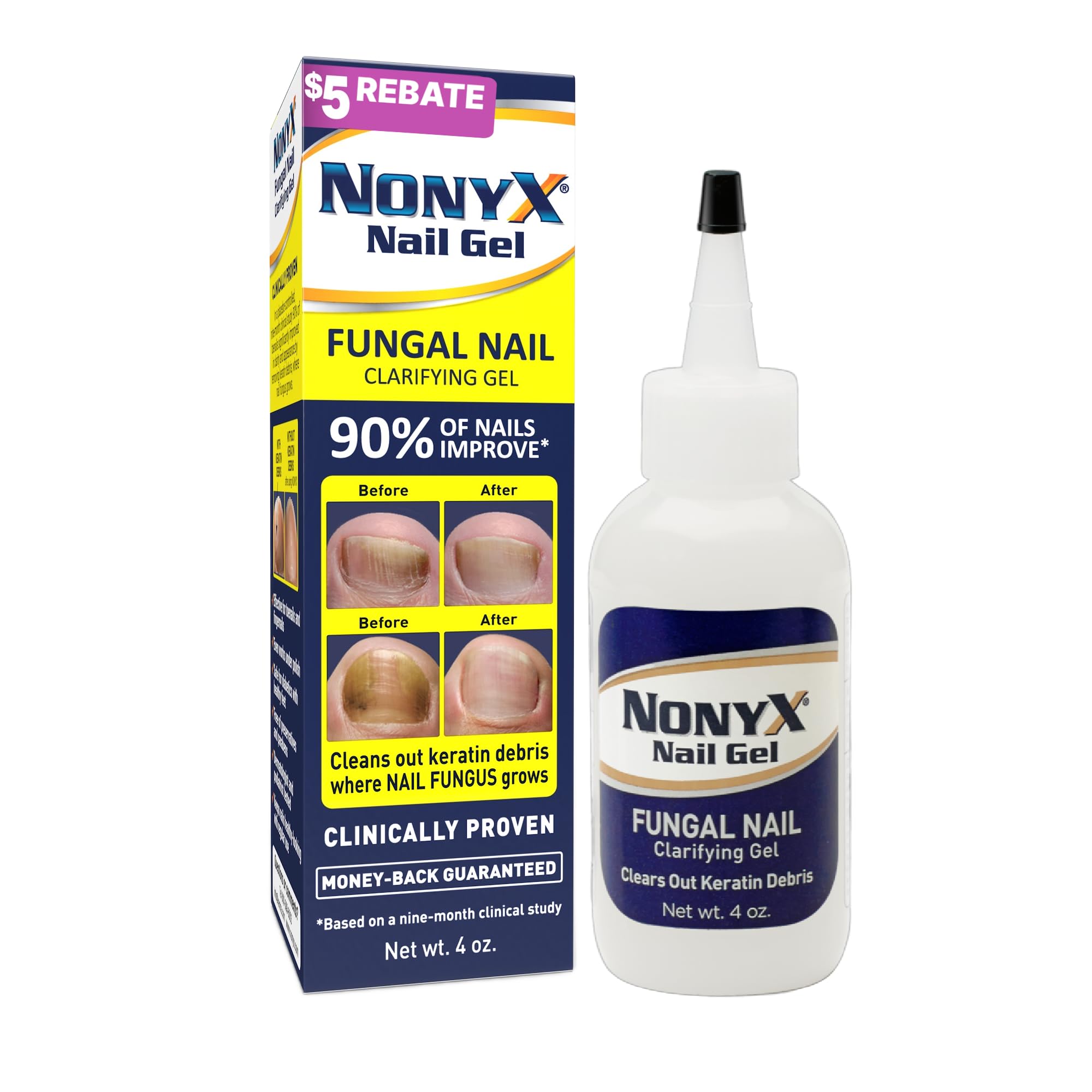NONYX Fungal Nail Clarifying Gel | Clinically Proven for Discolored, Thick, Brittle, Yellow, Lifted, and other signs of Fungus-Damaged Toenails | 90% of Nails Improve | Over 8 million sold