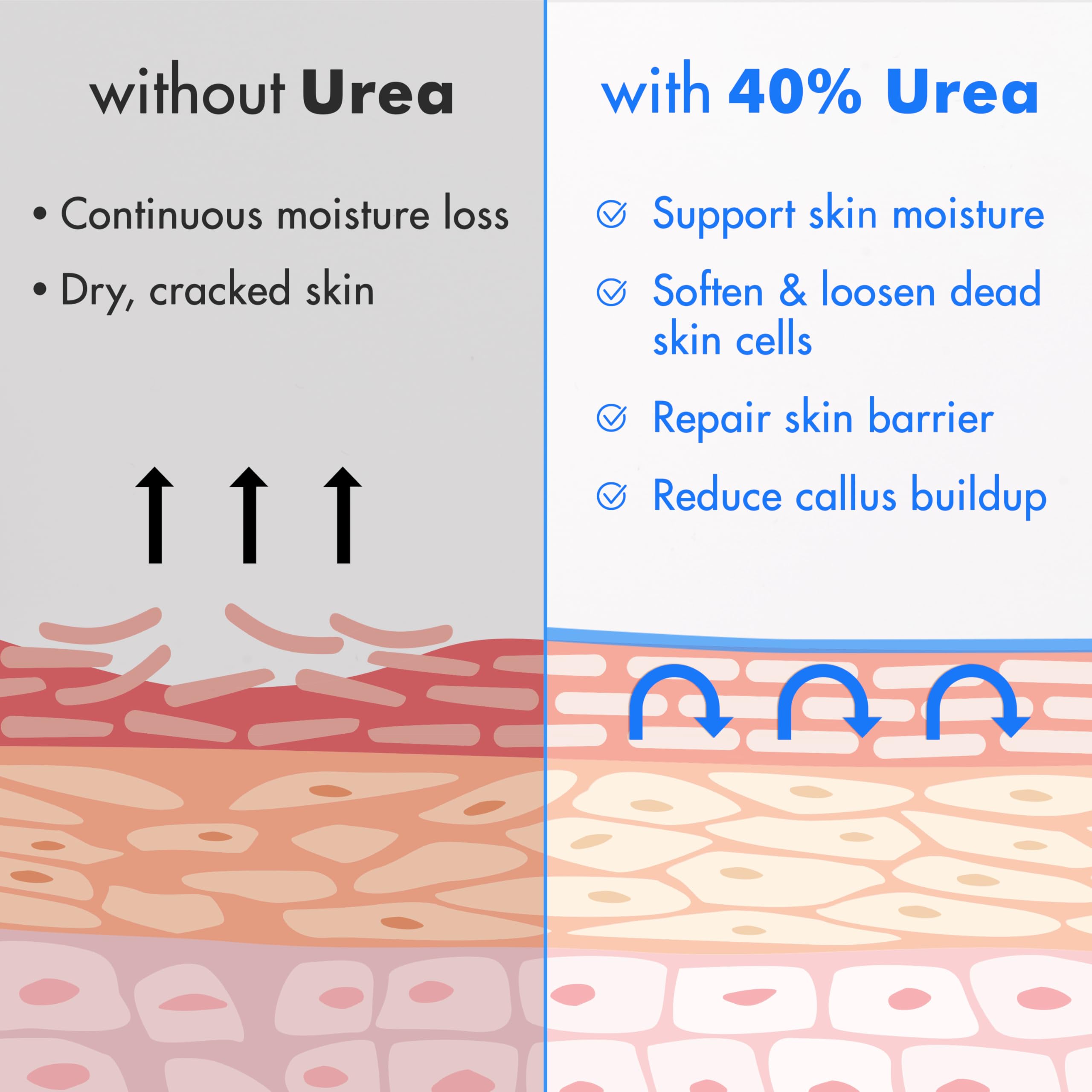 Ebanel Urea Cream 40% plus Salicylic Acid 2%, Foot Cream for Dry Cracked Heels Feet Knees Elbows Hands, Foot Dead Skin Cuticle Callus Remover Toenail Softener, Keratolytic Skin Barrier Repair