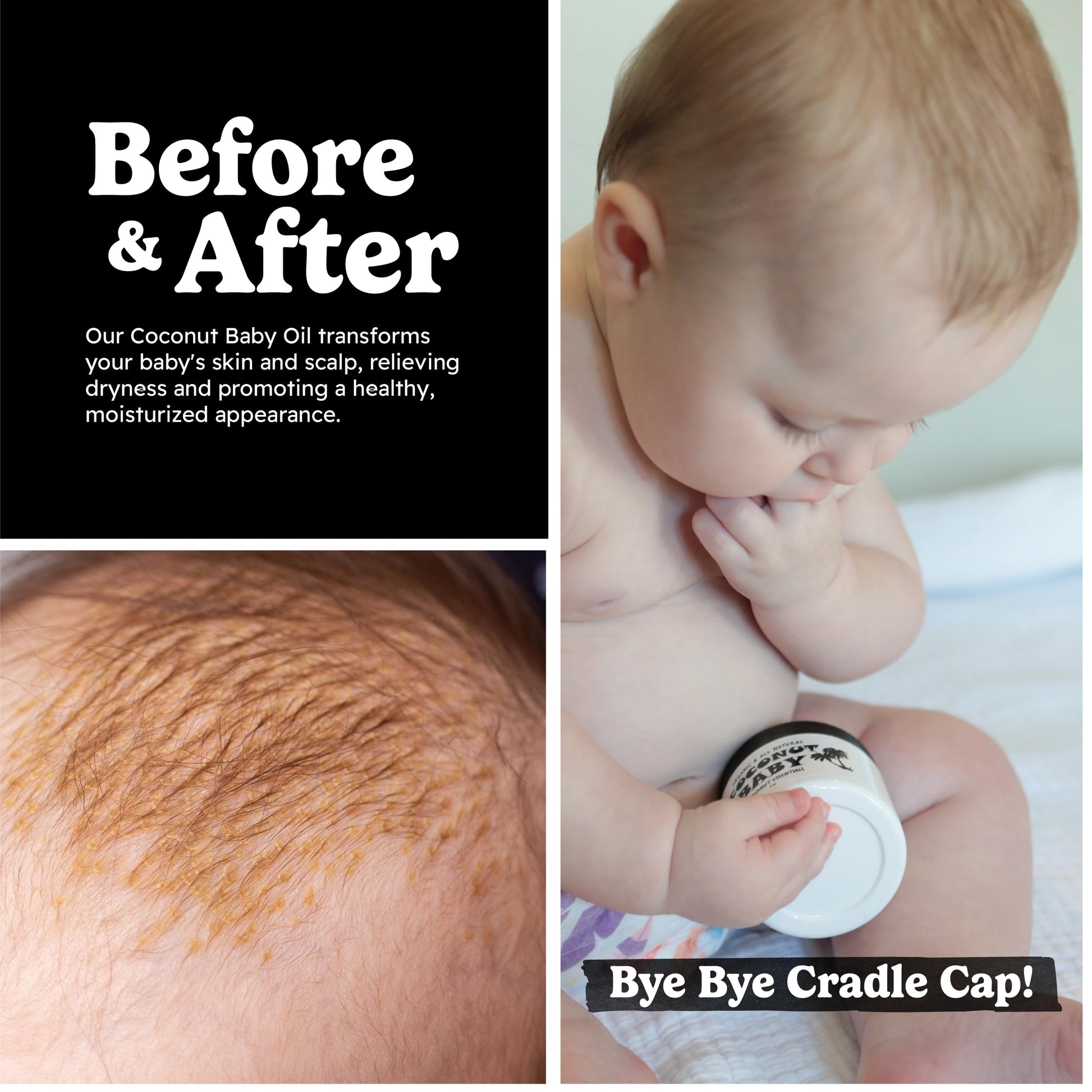 Coconut Baby Oil for Hair & Skin Care, Natural & Organic, Coconut Oil for Cradle Cap, Eczema, Infant Scalp Relief, Hair Oil for Curly Hair - Newborn Moisturizer for Sensitive Skin, Unscented - 2 fl oz